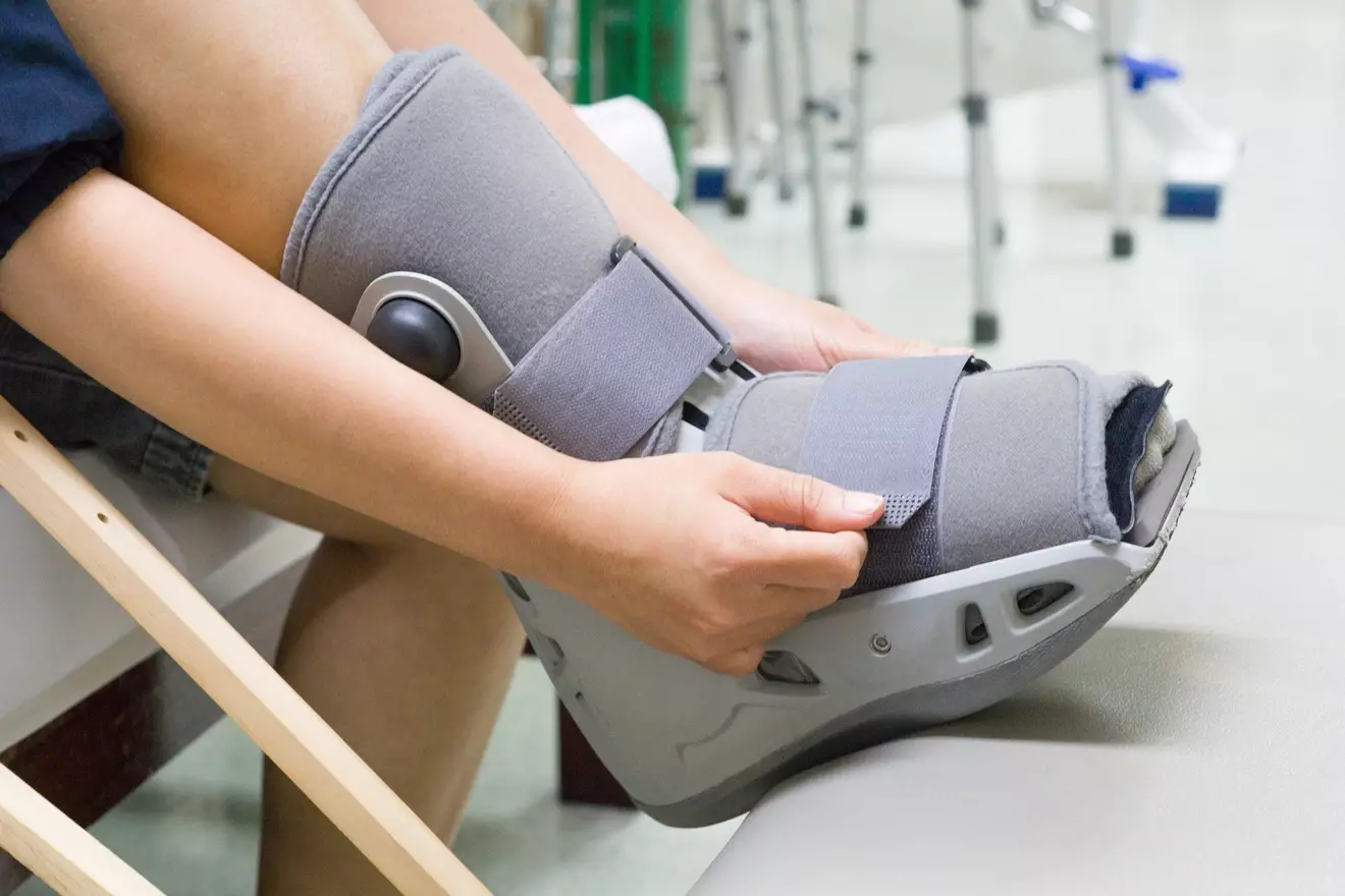 Ankle Replacement Recovery: 7 Key Facts About Surgery, Scars & Timeline