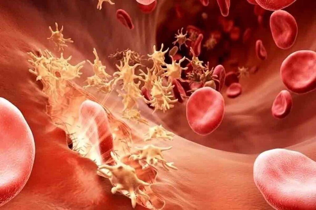 What Are Some Blood Disorders? 20 Common Conditions Explained