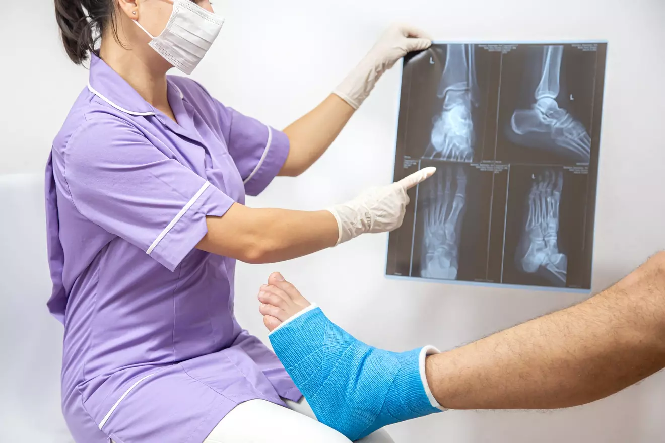 12 Key Facts About Ankle Joint Replacement: Recovery, Scars, and Results