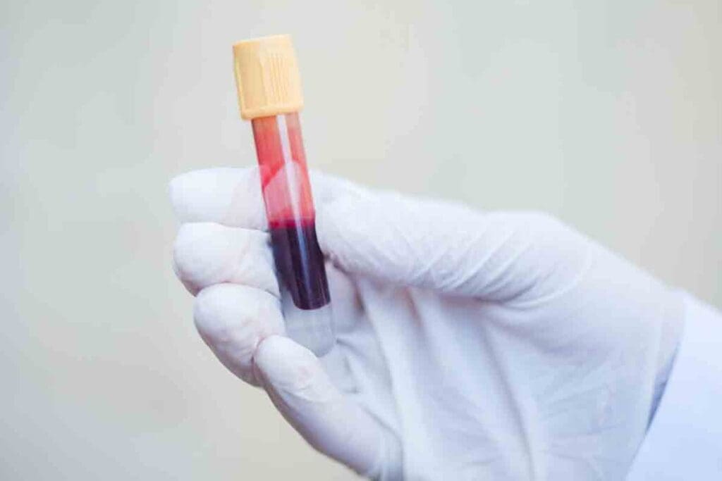 10 Different Types of Blood Disorders: Deadly and Common Blood Diseases Explained