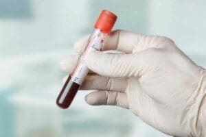 At-Home Blood Tests: CBC & Full Panels