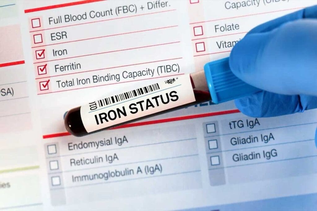 What Constitutes Low Iron Levels in Women? What Is a Low Iron Level for a Woman Explained

