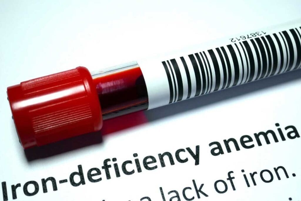 What Constitutes Low Iron Levels in Women? What Is a Low Iron Level for a Woman Explained

