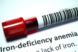 What Constitutes Low Iron Levels in Women? What Is a Low Iron Level for a Woman Explained