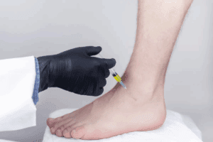 Compression Sleeves for Achilles Tendonitis: Ultimate Best Relief