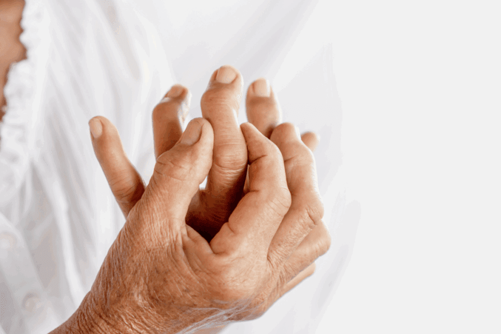 Conditions Mistaken for Osteoarthritis 2 Conditions Mistaken for Osteoarthritis