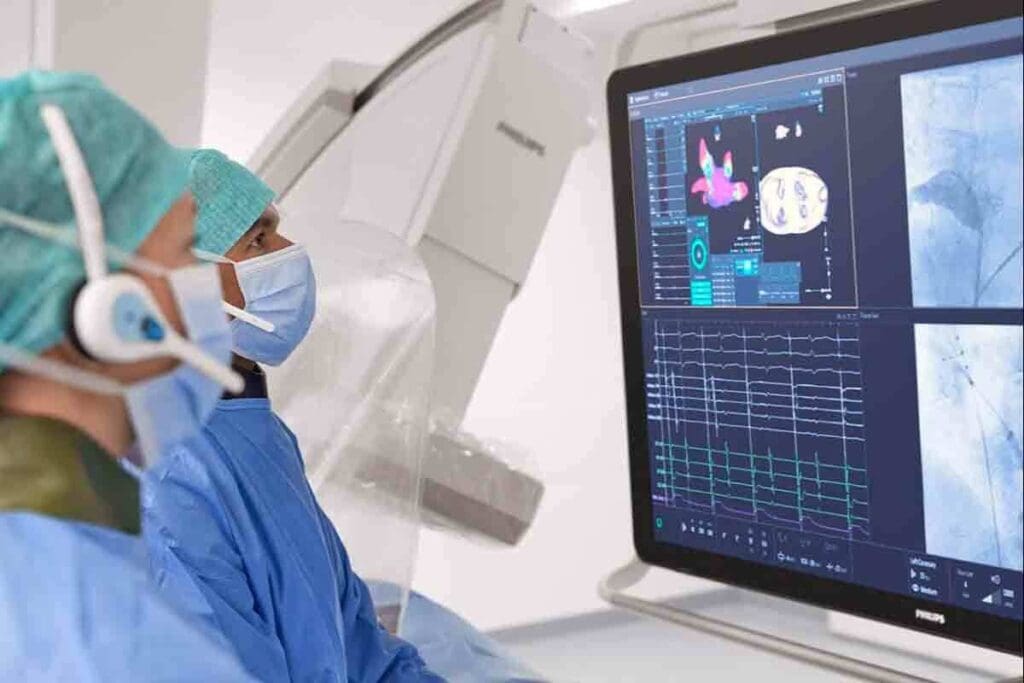 Cardiac SPECT Imaging: The Ultimate & Amazing Guide