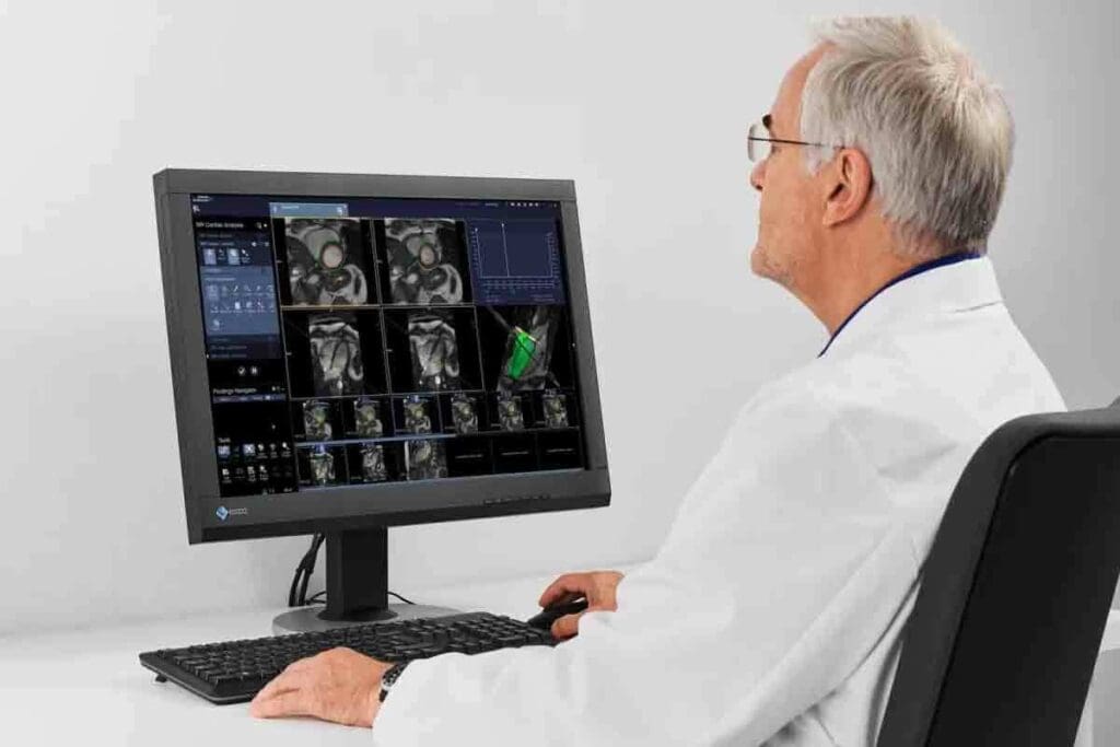 Cardiac SPECT Imaging: The Ultimate & Amazing Guide