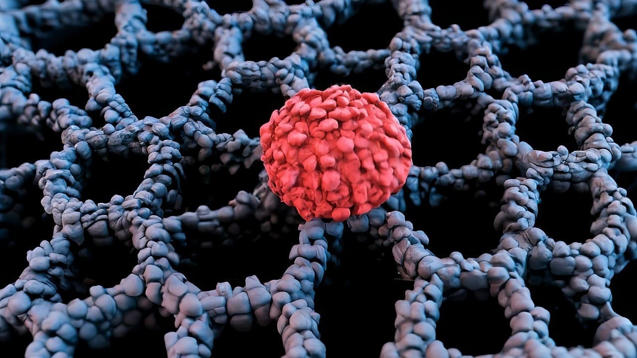 What Are the Symptoms and Treatment Options for Stage 4 Large B Cell Lymphoma?