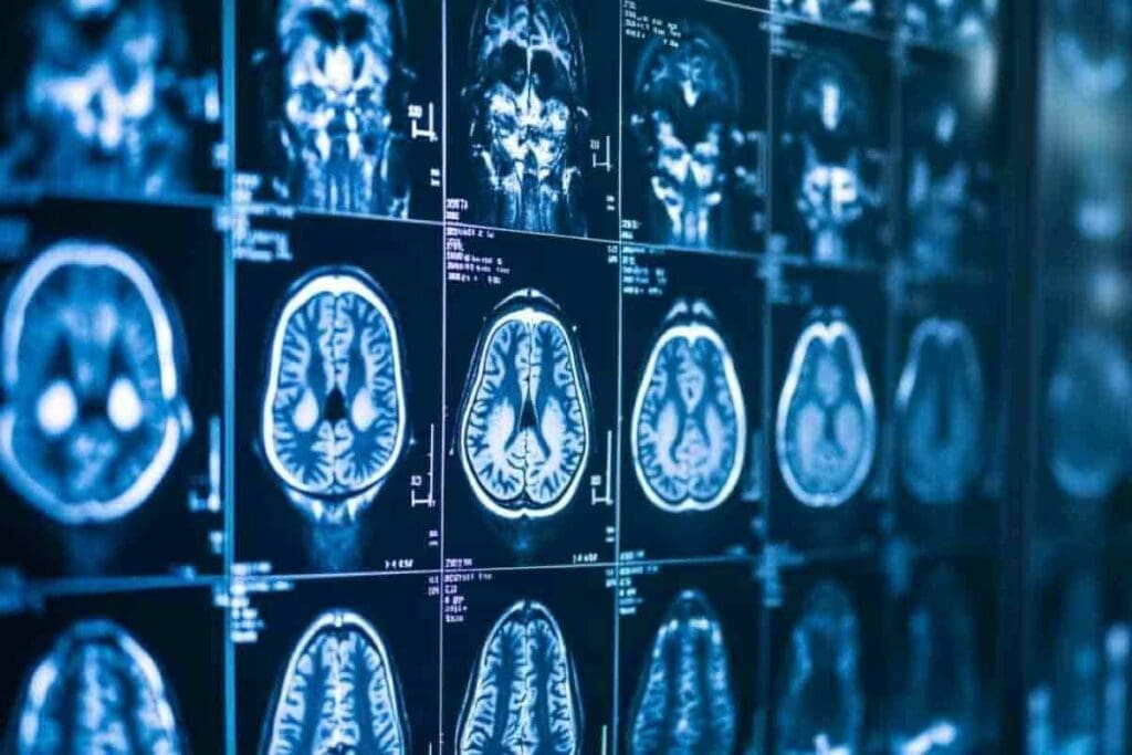 Functional MRI vs PET Scan: The Ultimate Comparison