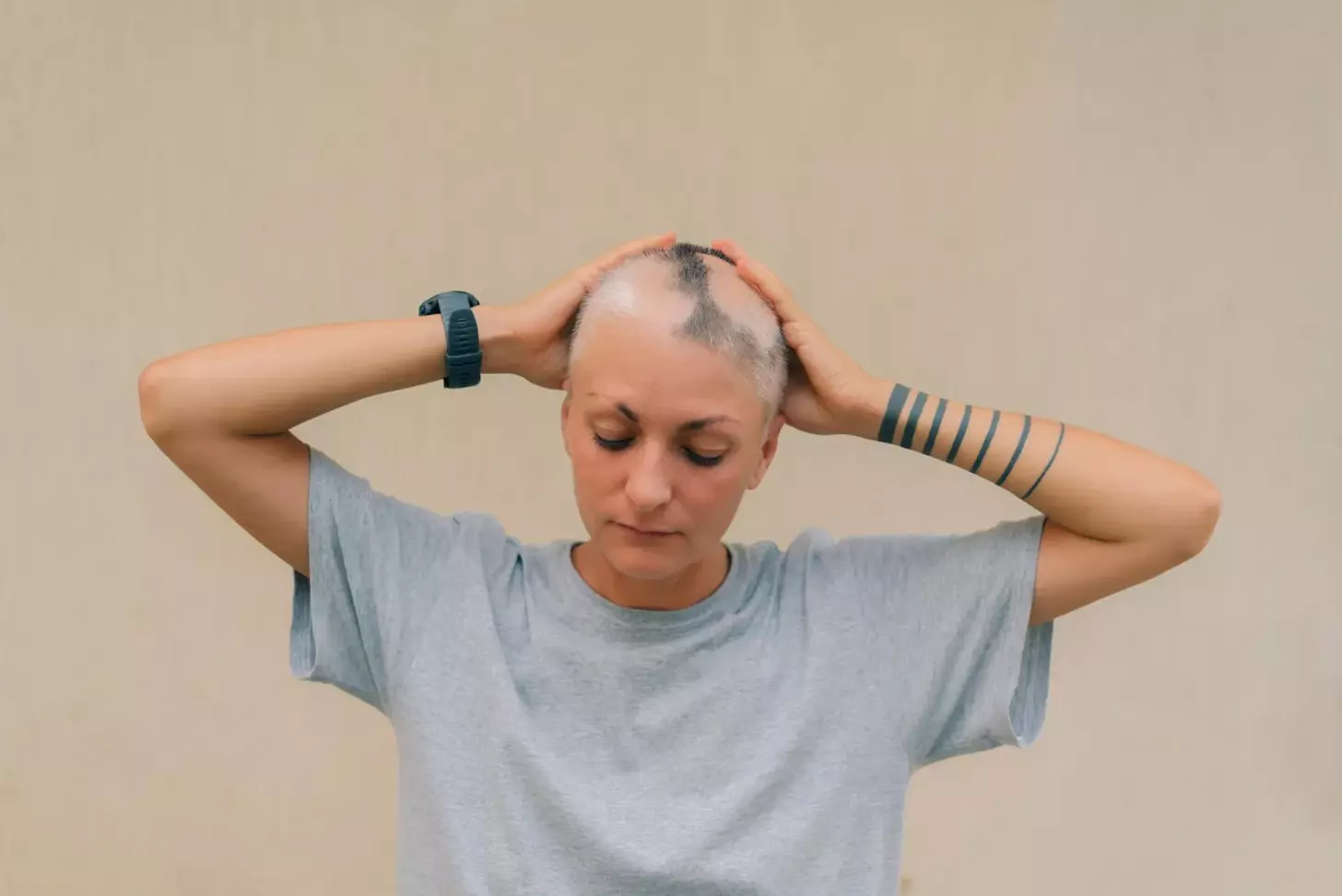 11 Practical Chemo Scalp Pain Relief Tips for Sore and Tender Scalps