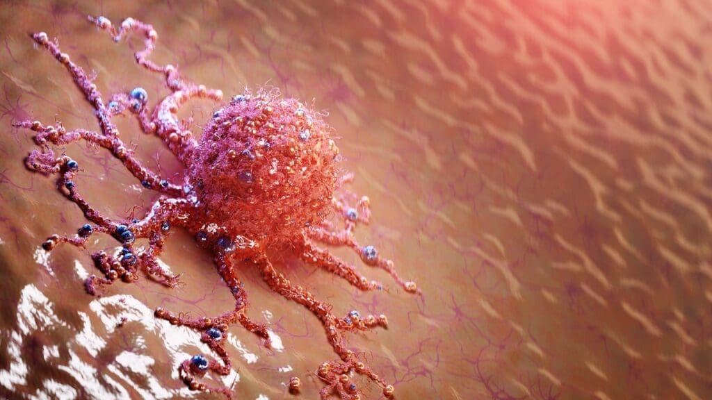 How Fast Do Melanomas Grow