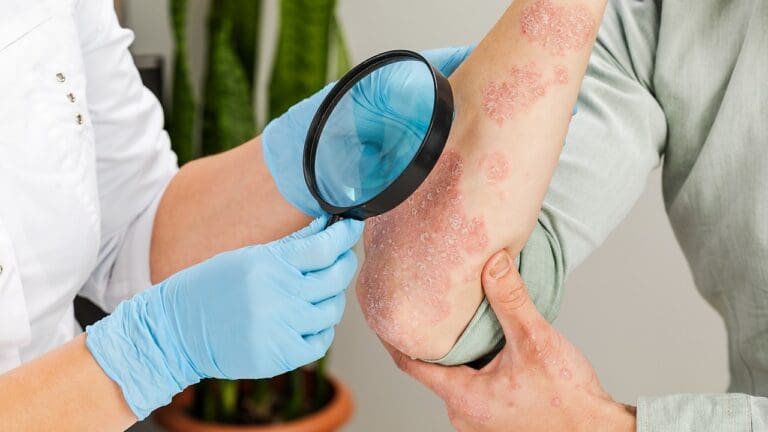 How Dangerous Is Melanoma, and What Happens If It Goes Untreated?