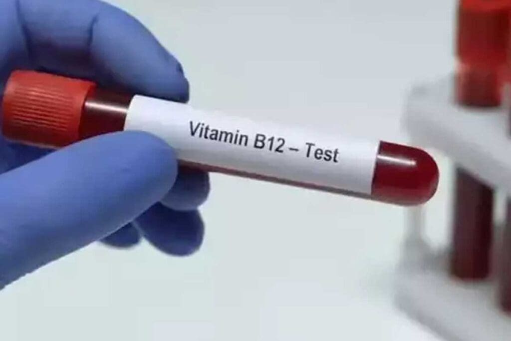 7 Other Names for Vitamin B12 (another name for vitamin b12): Cobalamin Explained for Confident Health