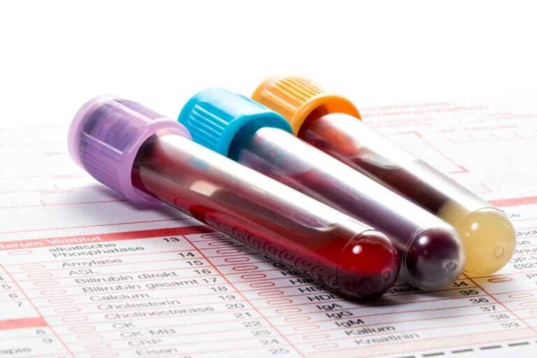 What Does Hemoglobin Measure on a Blood Test and Why Is It Important?