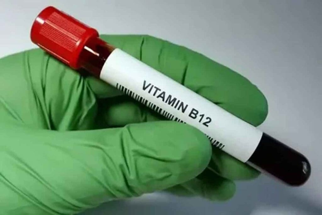 Vitamin B12 Injection Dose for Adults: 7 Key Facts on Dosage & Frequency