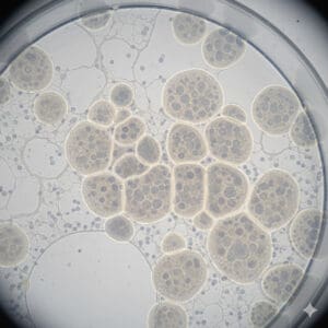 How Are Human Embryonic Cells Used in Stem Cell Research and Medicine?