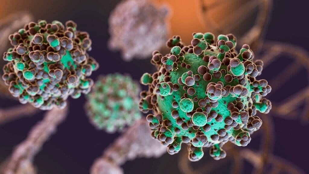 Large B-Cell Lymphoma (DLBCL)