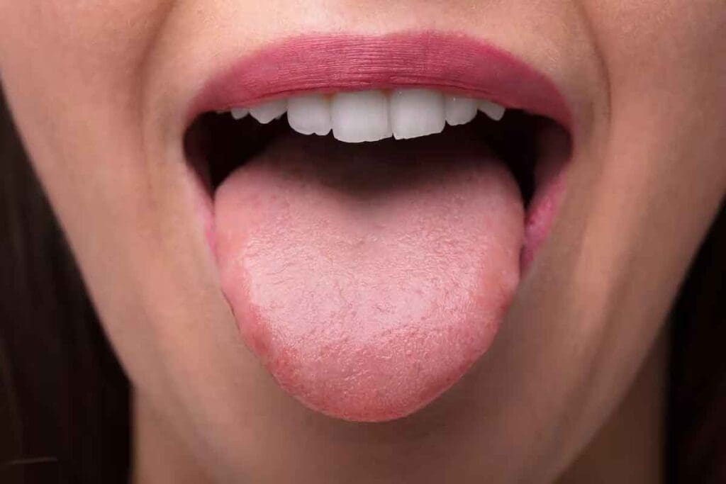 Iron Deficiency on Tongue: 7 Key Symptoms and Signs to Watch For