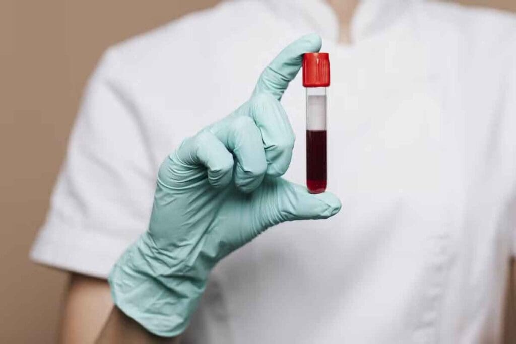 What Does an HB (Hemoglobin) Test Reveal About Your Health?
