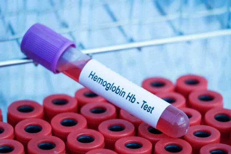 What Does Hemoglobin Mean and Why Is It Important in Blood Tests?