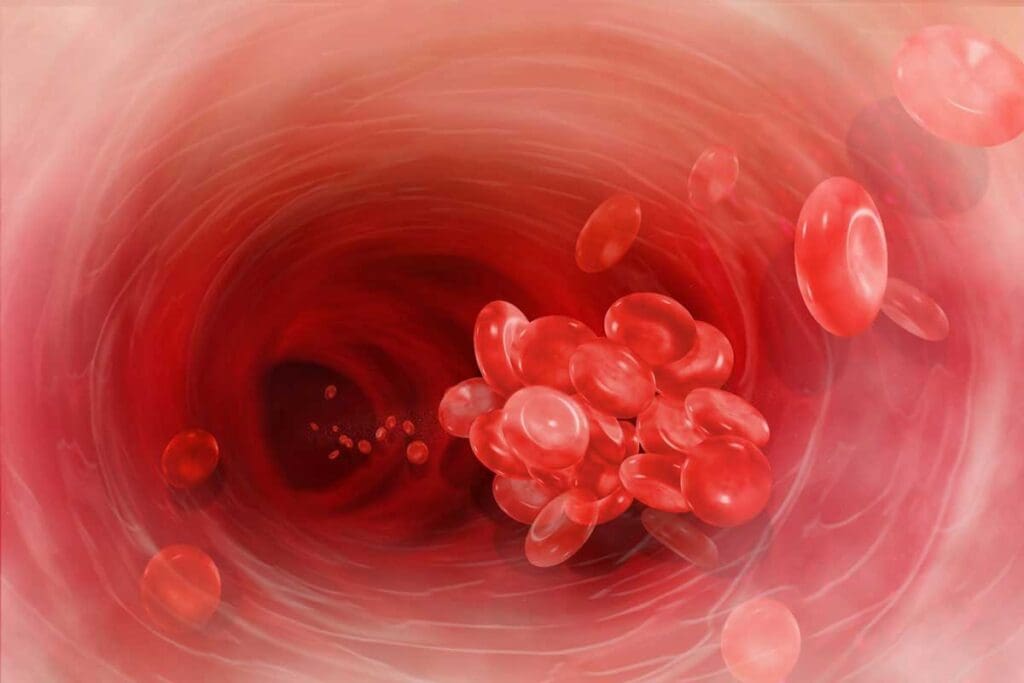 What Is Thrombosis? Thrombosis Definition, Blood Clot Causes, and Key Symptoms Explained 1 What Is Thrombosis? Definition, Blood Clot Causes, and Key Symptoms Explained