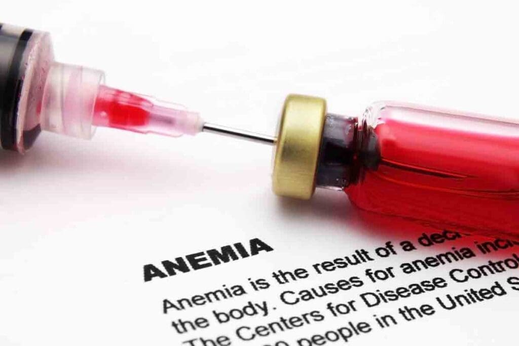Anaemia of Chronic Disease: 7 Essential Lab Findings and Iron Profile Markers to Know