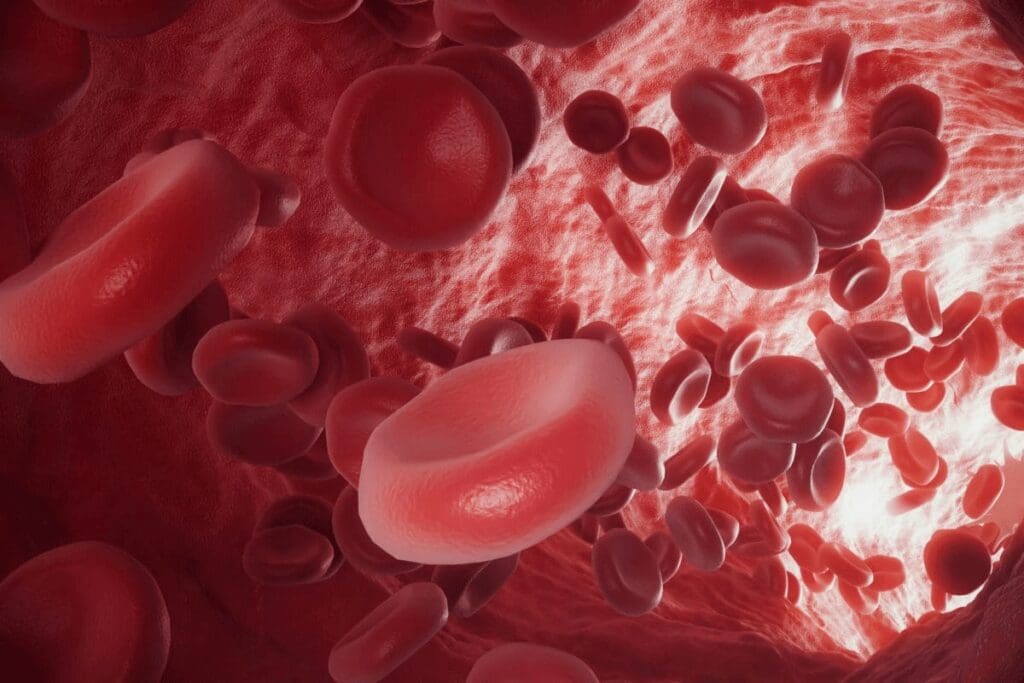 How Can You Die From Anemia? Causes, Risks, and Prevention Explained