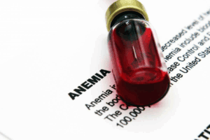 7 Key Causes of Acute on Chronic Anemia and Acute Blood Loss Anemia