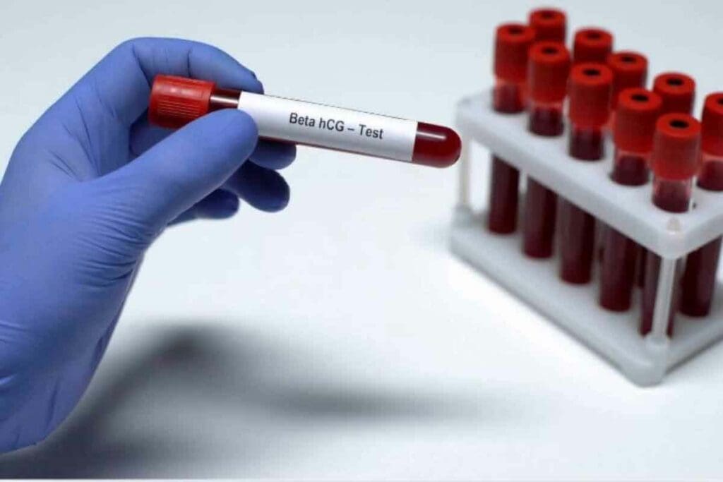 Acute Leukemia Blood Test: 5 Essential Tests for Accurate Diagnosis
