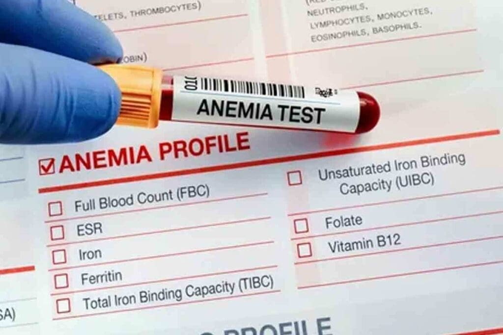 What Is Acute Blood Loss Anemia and How Is It Clinically Recognized? 1 What Is Acute Blood Loss Anemia and How Is It Clinically Recognized?