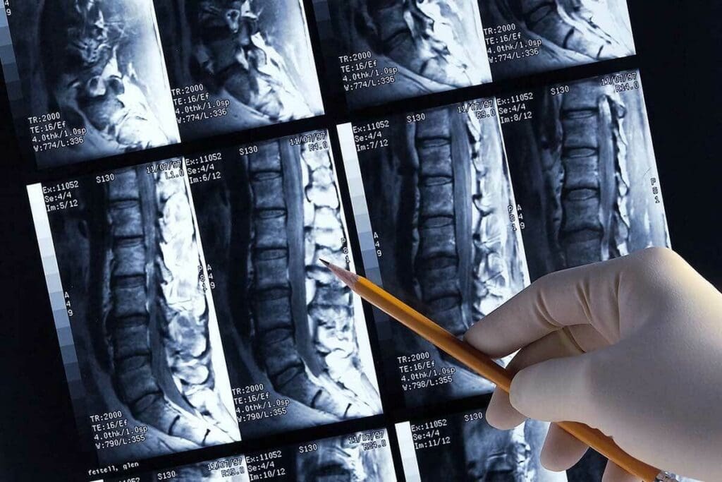 Are CAT Scans and Bone Scans the Same Thing?