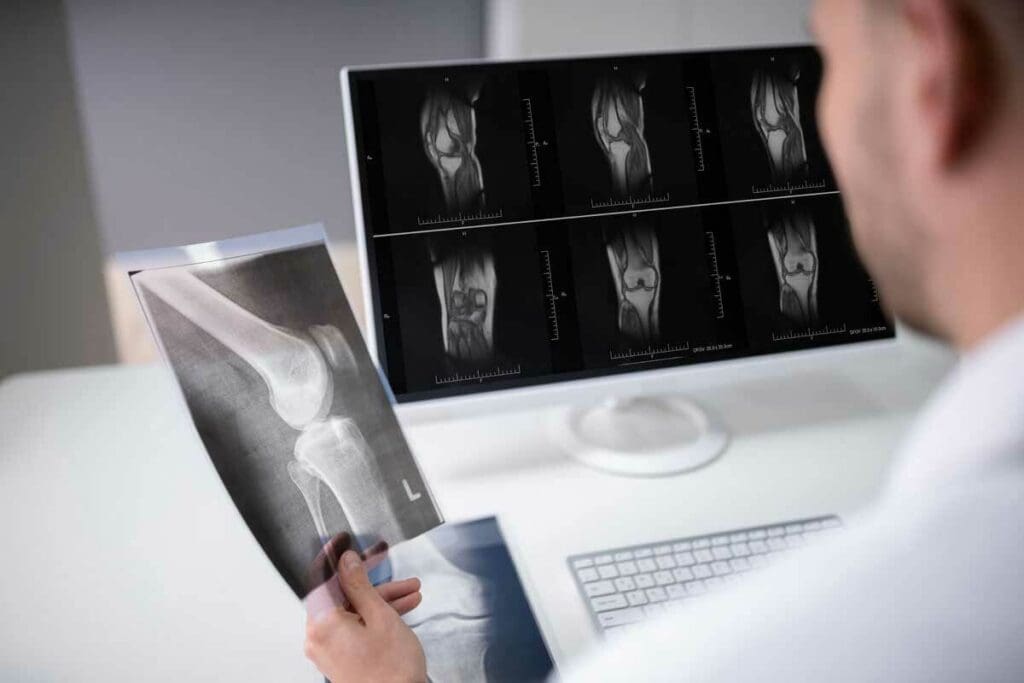 Are CAT Scans and Bone Scans the Same Thing?
