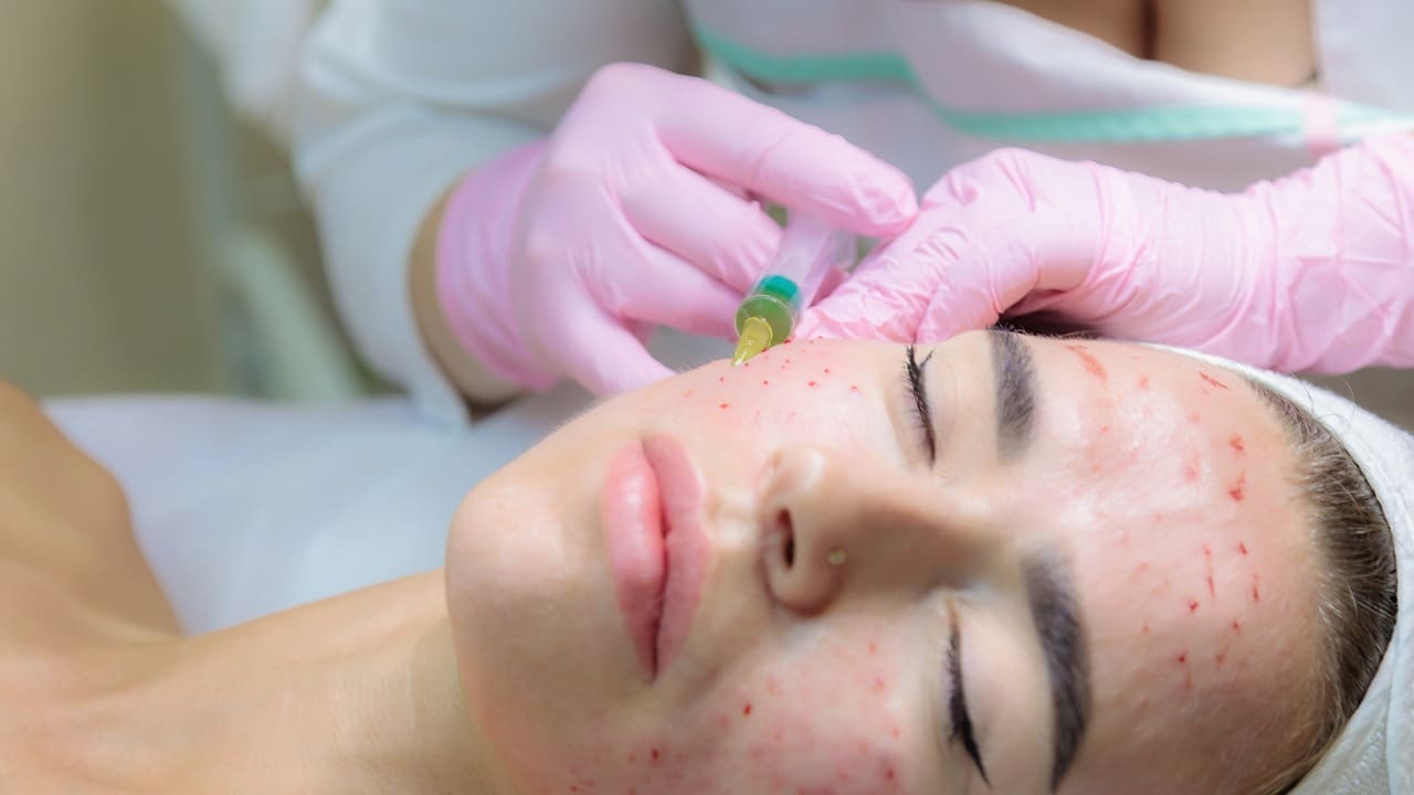 7 Effective Treatments for Basal Cell Skin Cancer on the Face