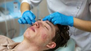 What Are the Treatment Options for Basal Cell Cancer Tissue Scraping on the Nose?