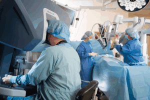 Robotic Lung Surgery Recovery Time: How Quick is the Amazing Heal?