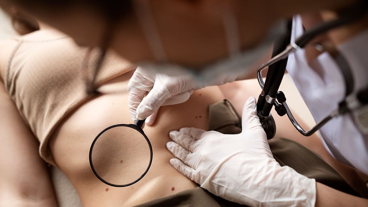How to Remove Basal Skin Cancer: Step-by-Step Surgical Procedures