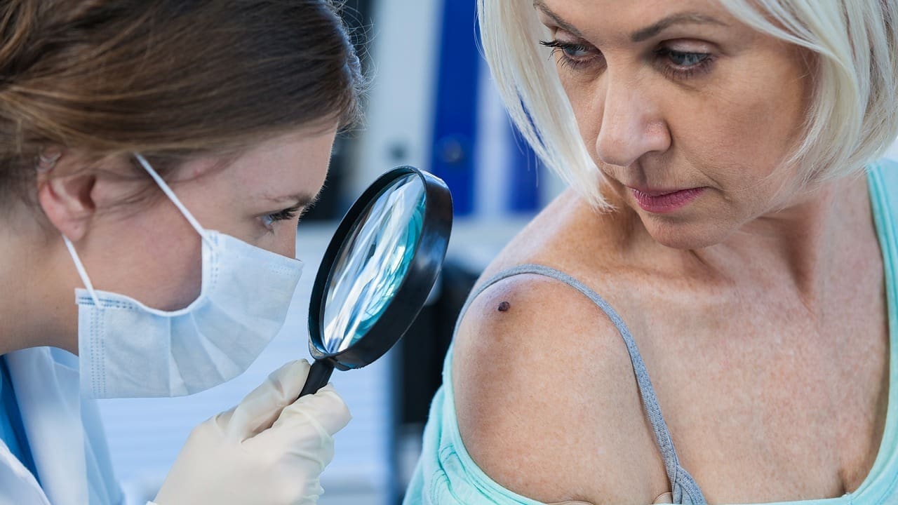 How to Remove Basal Cell Skin Cancer: A Step-by-Step Guide 1 How to Remove Basal Cell Skin Cancer: A Step-by-Step Guide