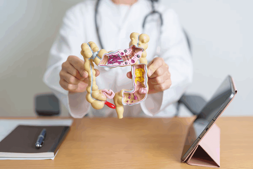 Robotic Colon Surgery for Diverticulitis Guide