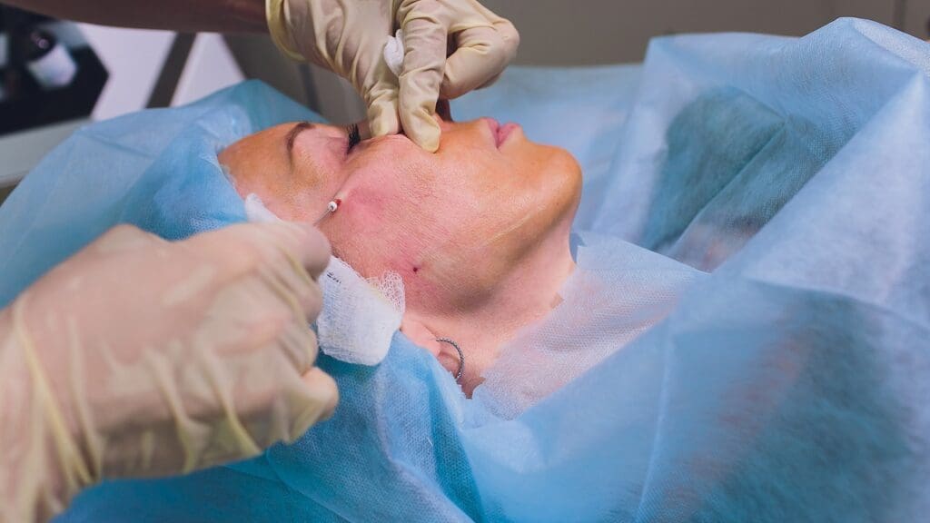 Mohs Surgery for Basal Cell Carcinoma