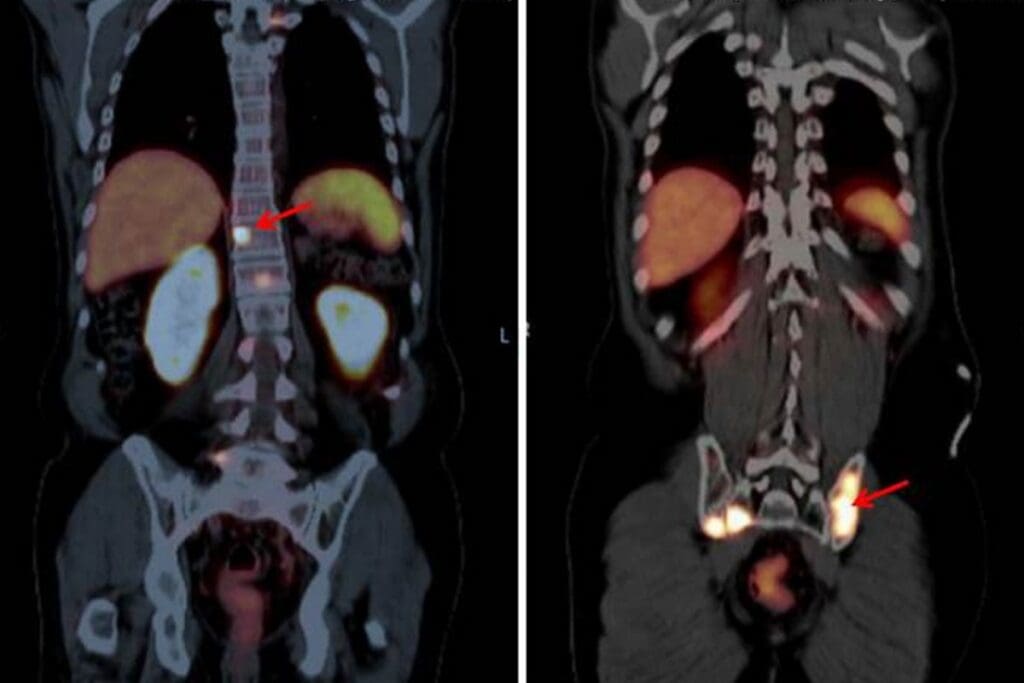 Is a CT Urogram Done With or Without Contrast Dye? 3 Is a CT Urogram Done With or Without Contrast Dye?
