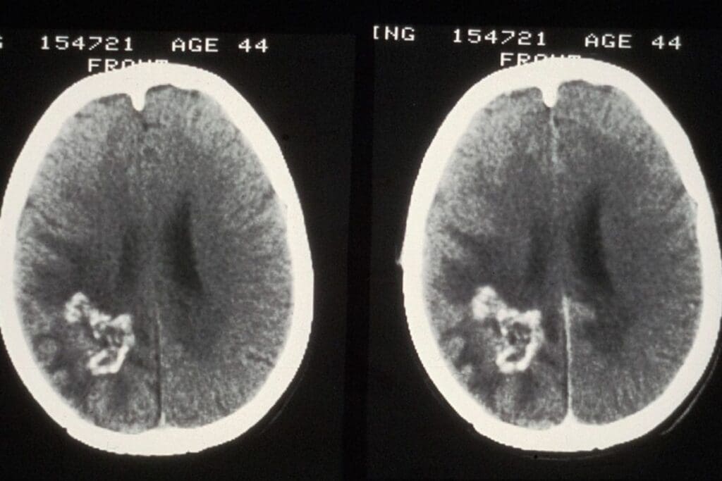 Is a CT Urogram Done With or Without Contrast Dye? 1 Is a CT Urogram Done With or Without Contrast Dye?