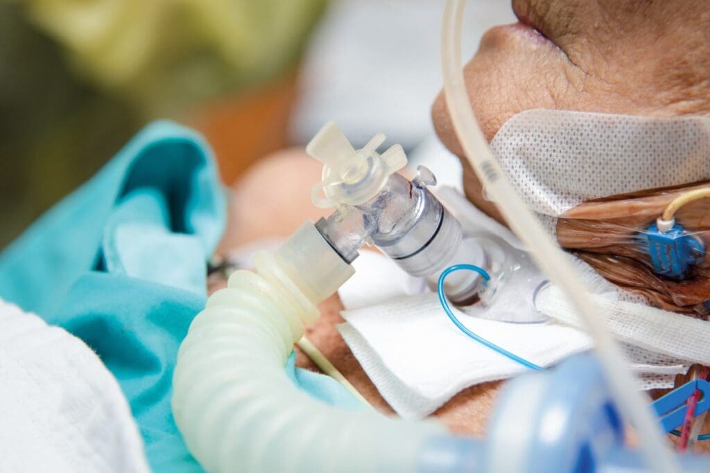 Stertor: Sign of This Common Obstruction 3 Stertor: Sign of This Common Obstruction