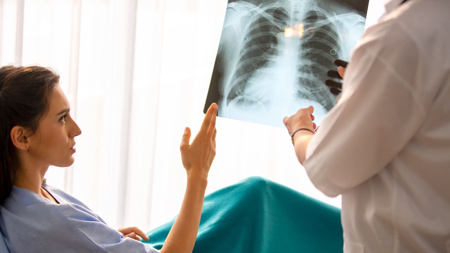 15 Holistic and Natural Treatments for Lung Cancer: Quick Guide 1 15 Holistic and Natural Treatments for Lung Cancer: Quick Guide