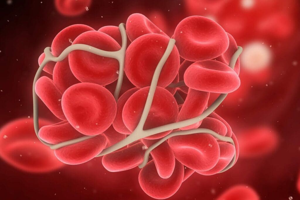 5 Powerful Facts About Obinutuzumab: An Effective Cancer Treatment Drug