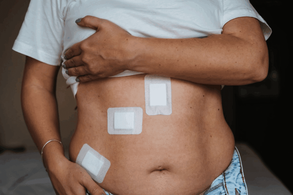 Pediatric Hernia Surgery: recovery from inguinal hernia surgery 2 Pediatric Hernia Surgery: recovery from inguinal hernia surgery