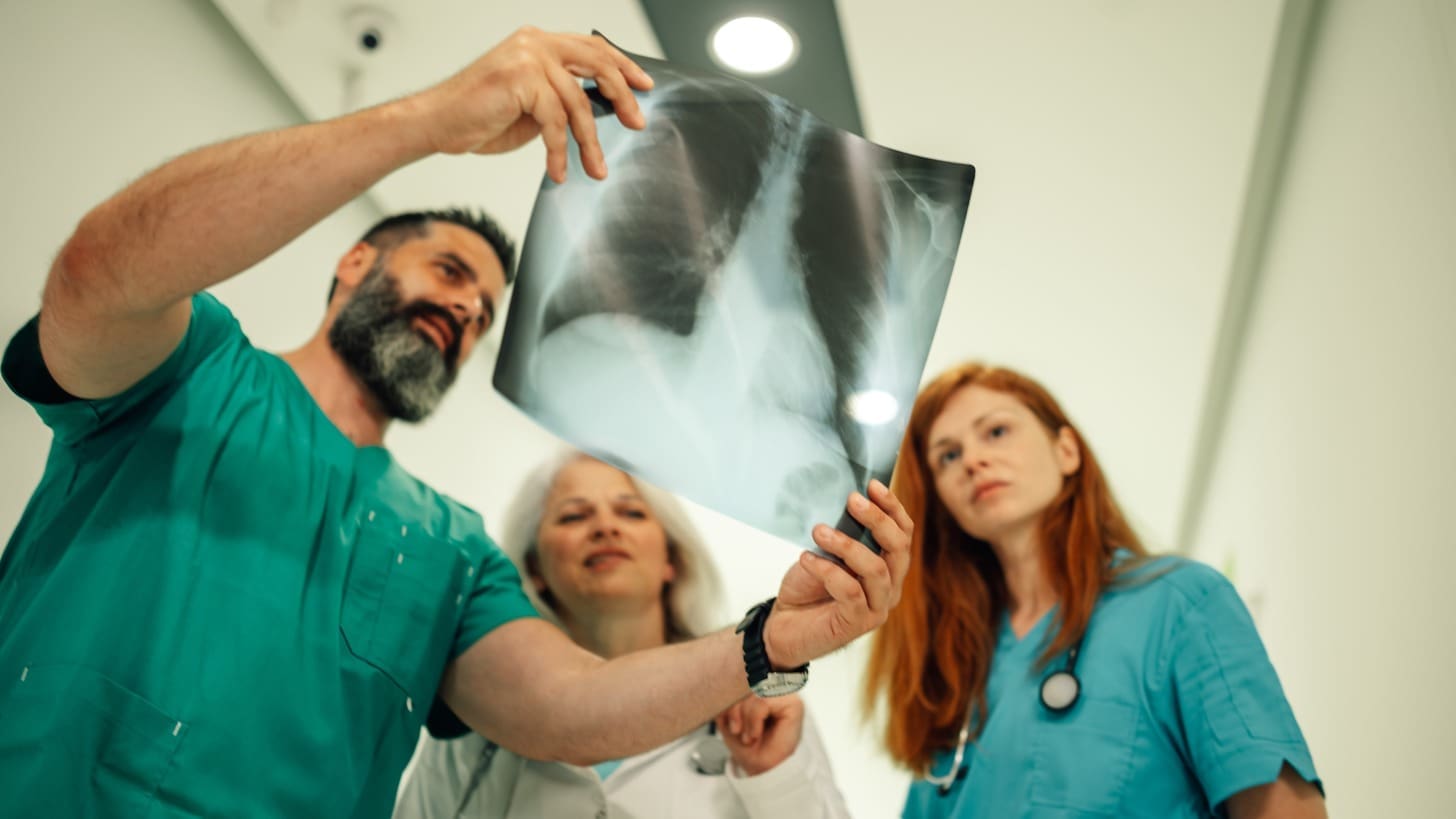 11 Holistic Treatments for Lung Cancer: Natural Ways to Support Care