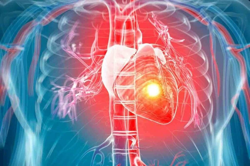 Cardiac SPECT: The Ultimate Guide to This Amazing Test