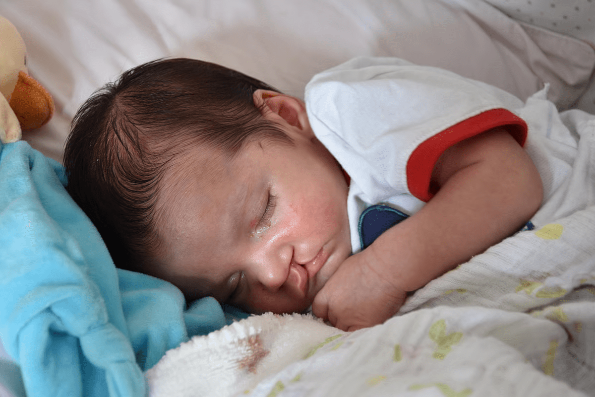 Best Age Hernia Surgery: 5 Key Facts About Down’s Syndrome & Anomalies