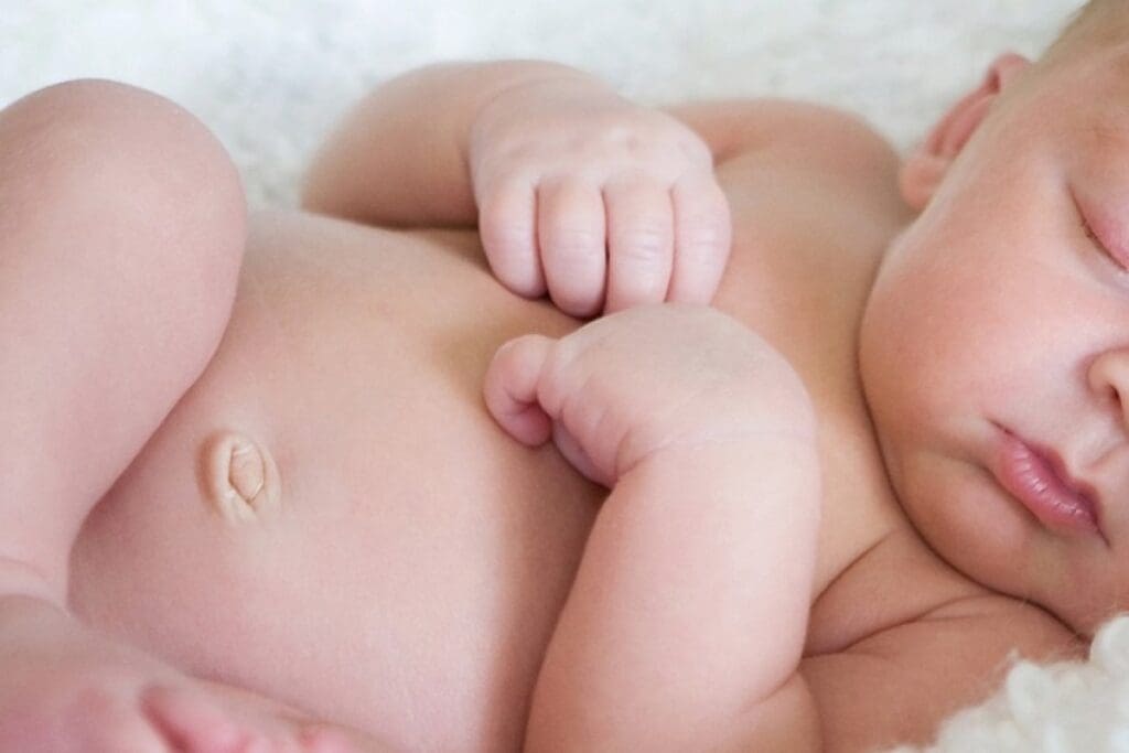 Treating a Hernia in a Child: Options & Care 3 Treating a Hernia in a Child: Options & Care